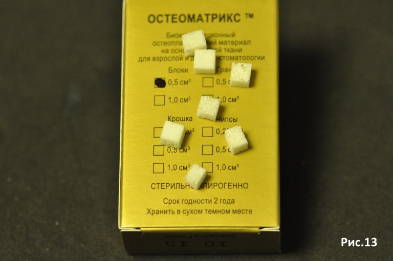 Остеоматрикс блоки