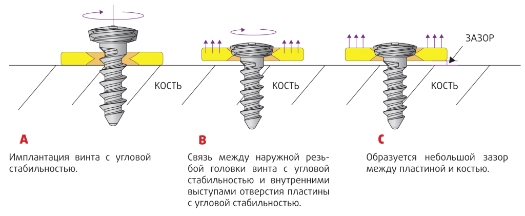 Мини-винты 2,0 мм с угл/стаб