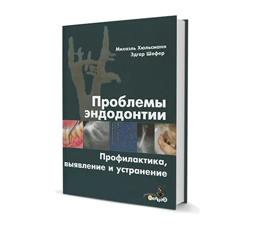 Проблемы эндодонтии. Профилактика, выявление и устранение