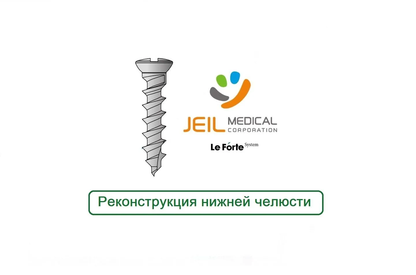 Реконструкция Нижней челюсти Винты Макси