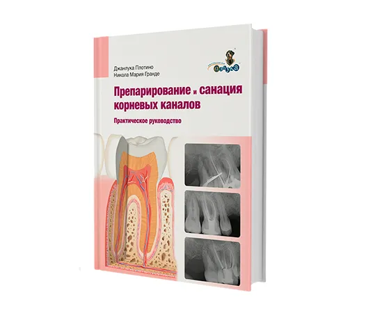 Практическое руководство. Препарирование и санация корневых каналов