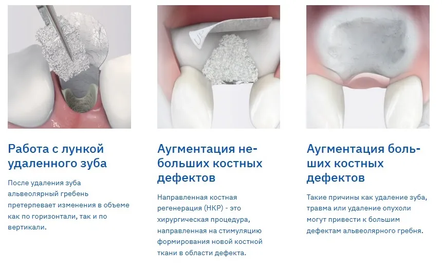 Способ применения1.jpg