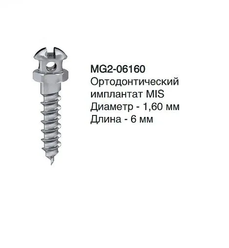 MG2-06160