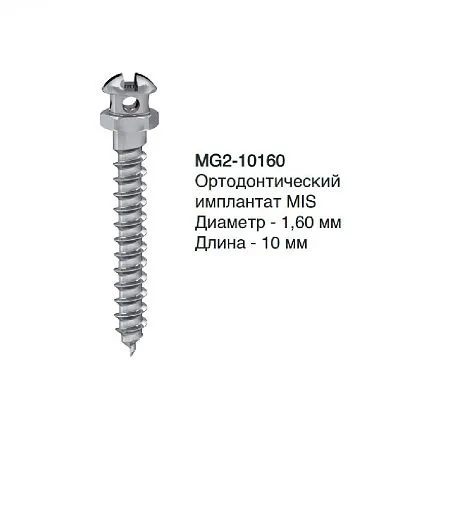 MG2-10160