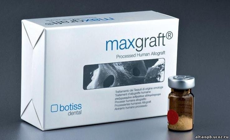 Maxgraft