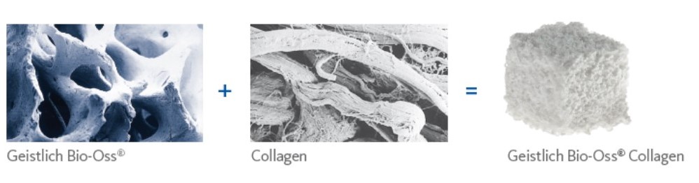 Состав материала Bio-Oss Collagen