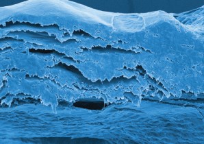 Сканирующая электронная микроскопия: коллагеновый матрикс мембраны OsteoBiol Evolution