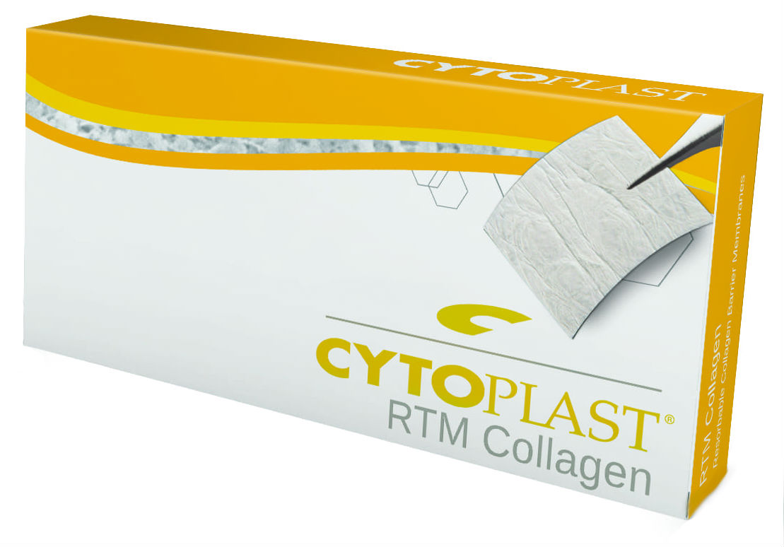 RTM Collagen