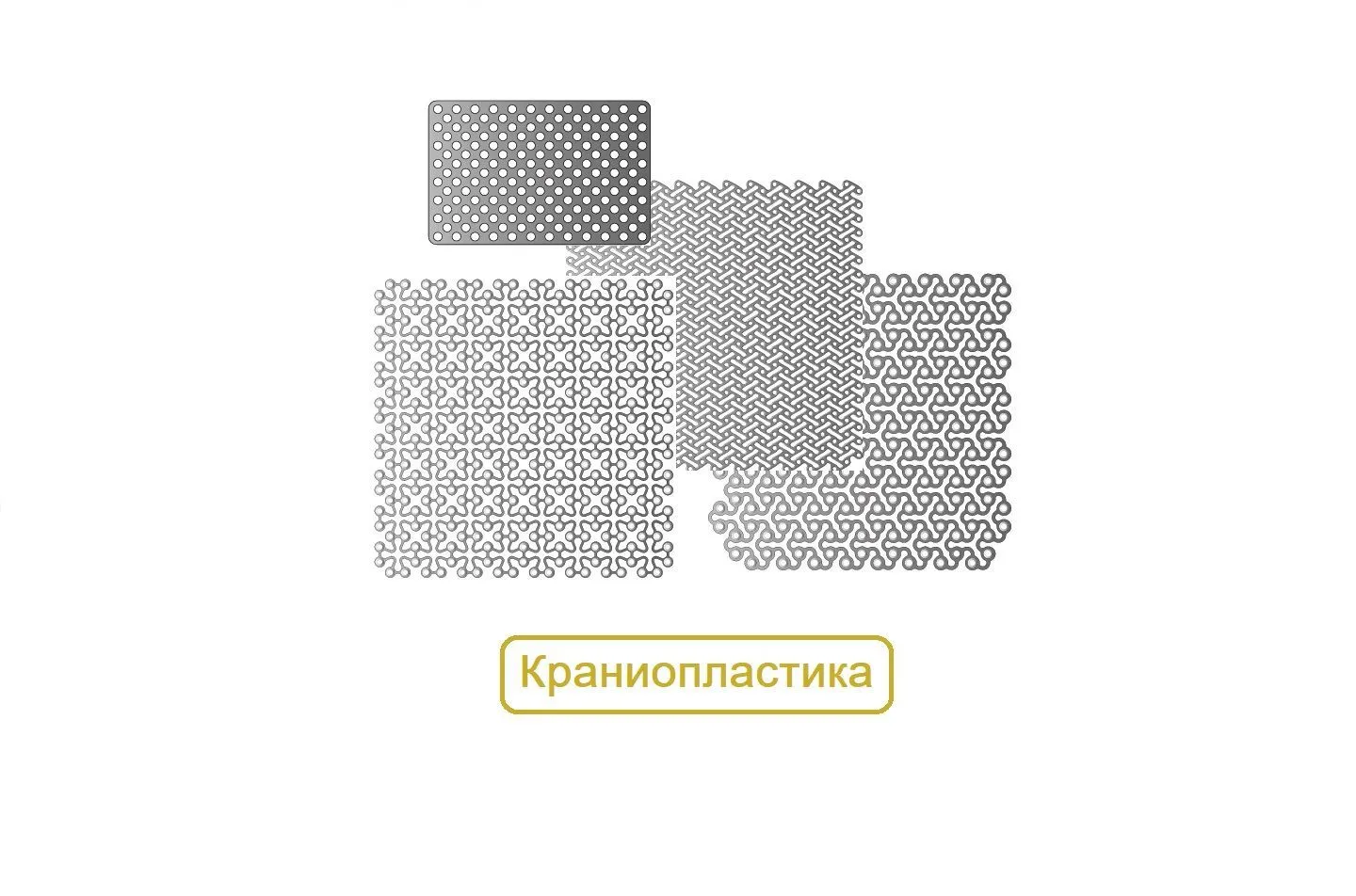 Краниопластика Пластины Микро, Миди, Мини