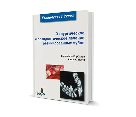 Хирургическое и ортодонтическое лечение ретинированных зубов