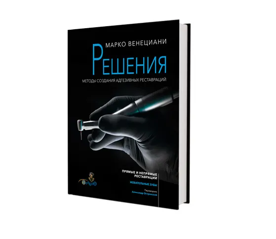 Решения. Методы создания адгезивных реставраций