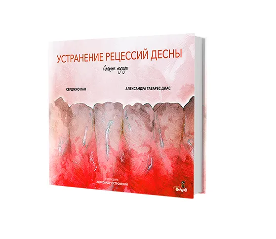 Устранение рецессий десны