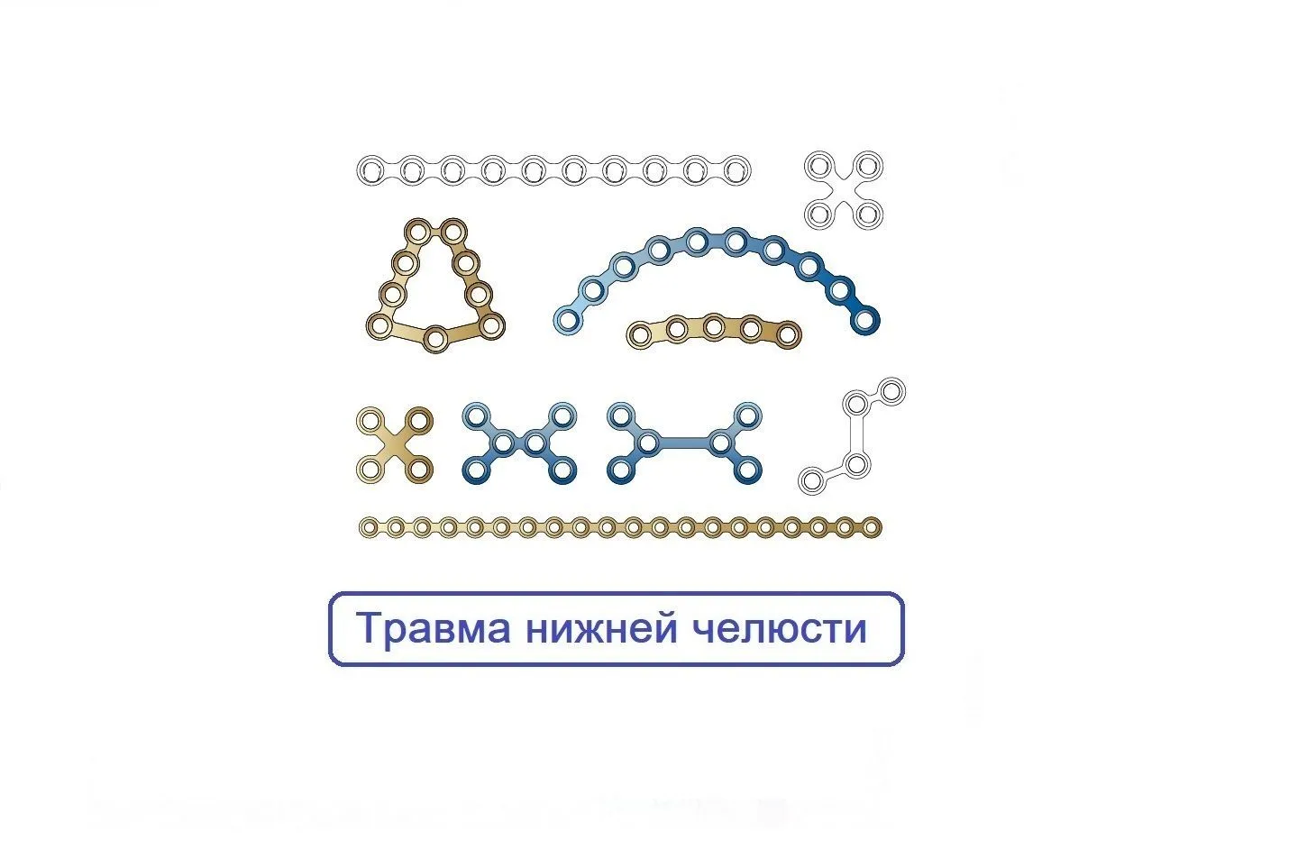 Трамва Нижней Челюсти Пластины Мини