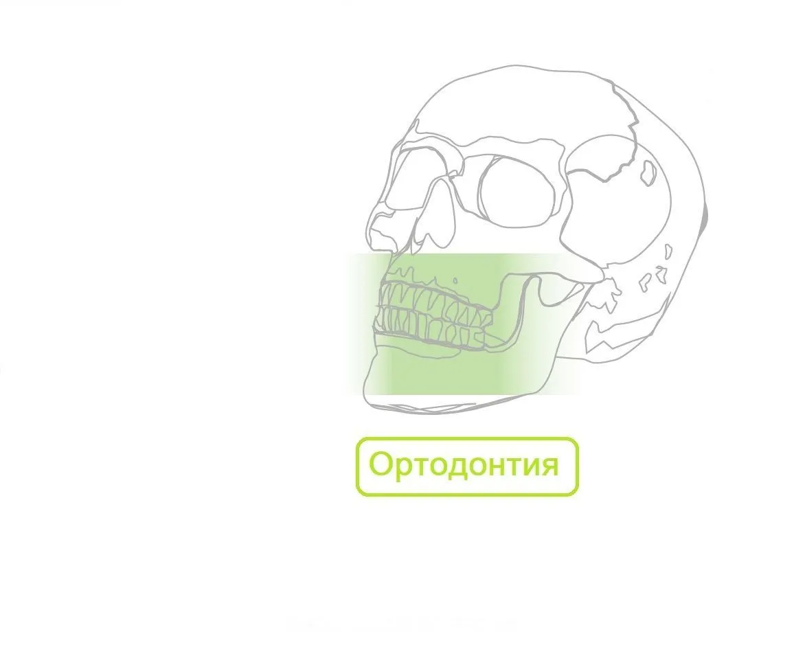 Ортодонтия Якорные небные пластины