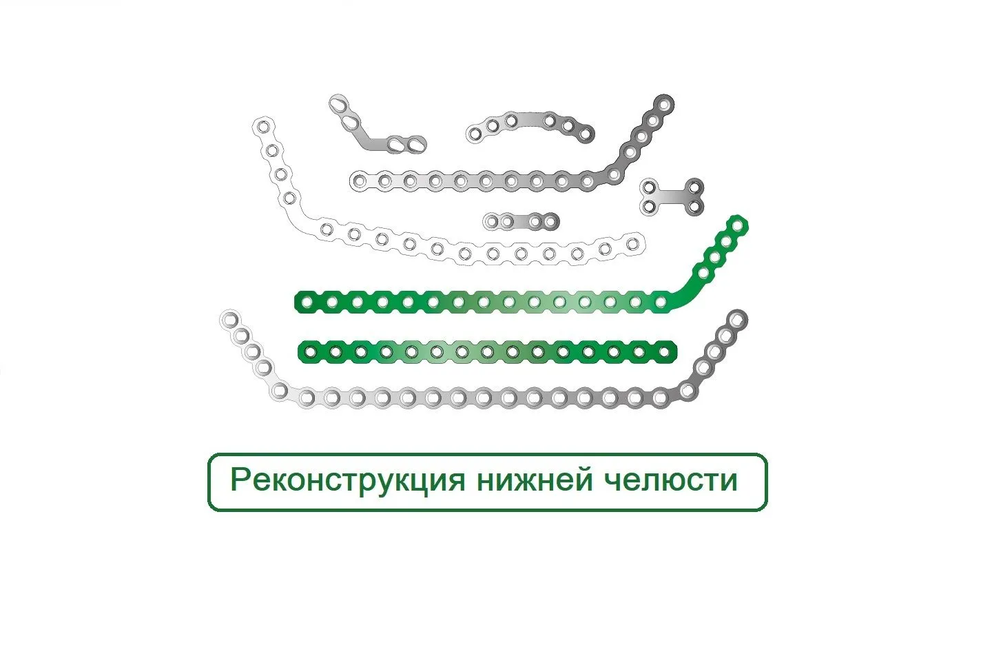 Реконструкция Нижней Челюсти Пластины Макси