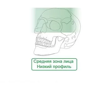 Средняя зона Пластины Миди NL с низким профилем