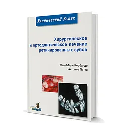 Хирургическое и ортодонтическое лечение ретинированных зубов