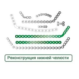 Реконструкция Нижней Челюсти Пластины Макси